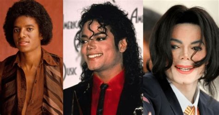 Michael Jackson Skin Condition: Unveiling the Truth Behind His Iconic Transformation